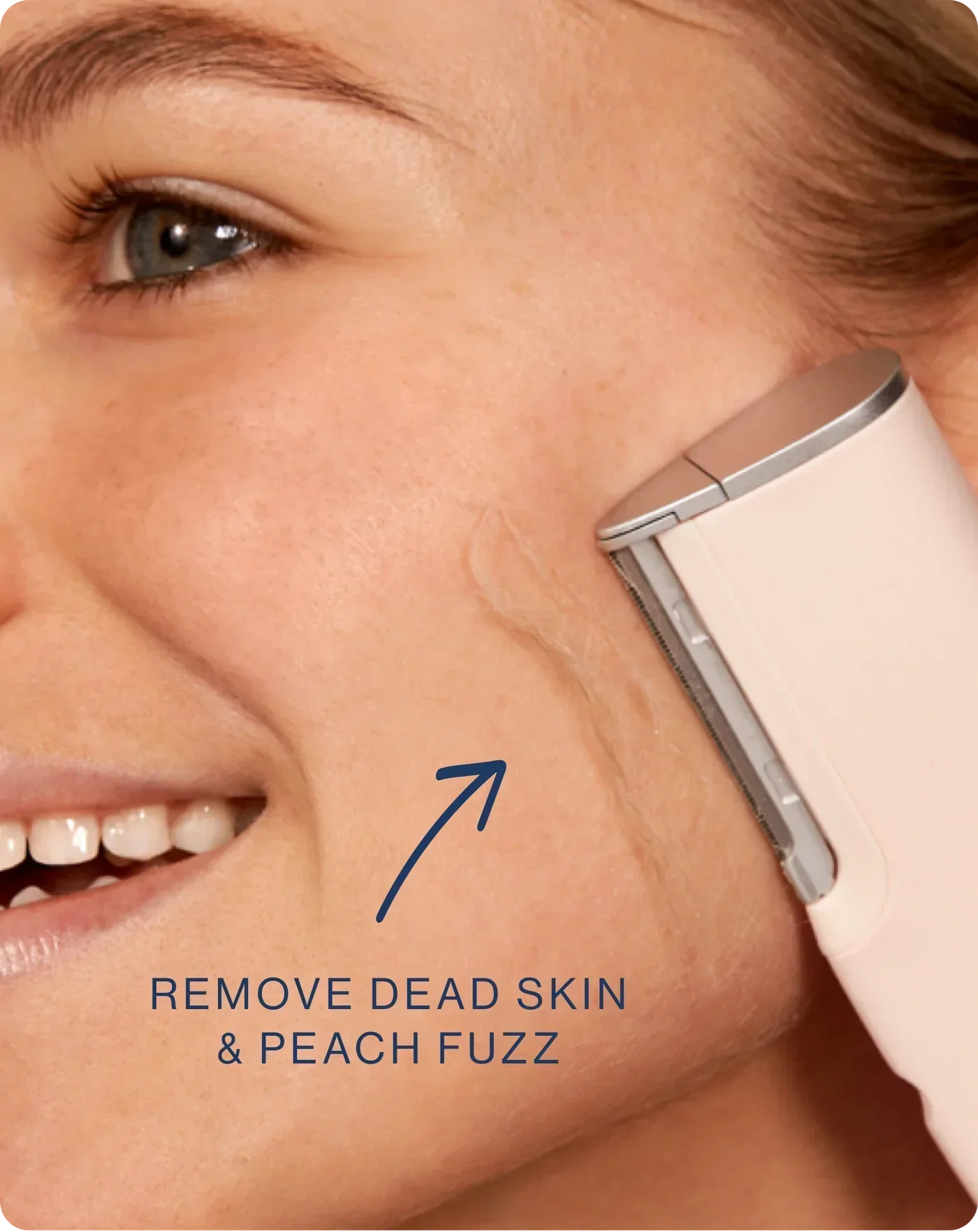 Freshylift® Dermaplanning