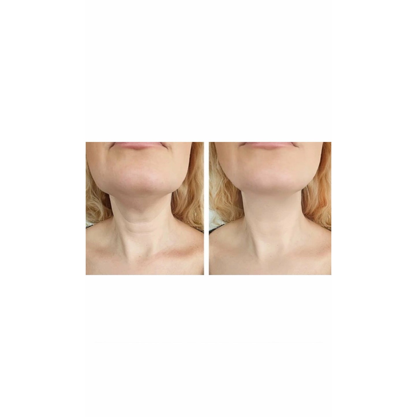 Freshtop® Gold Neck Mask
