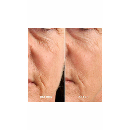 Top ® Collagen Eye Mask