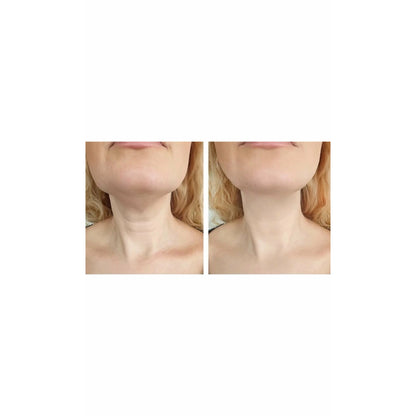 Freshtop® Gold Neck Mask